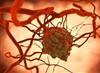 广州中山大学发现逆天病毒：天然病毒M1可杀灭癌细胞