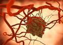 广州中山大学发现逆天病毒：天然病毒M1可杀灭癌细胞